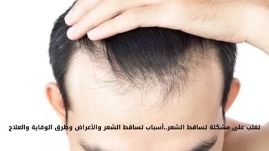 علاج تساقط الشعر وأسبابه