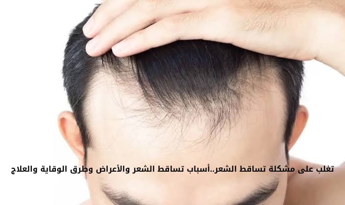 علاج تساقط الشعر وأسبابه