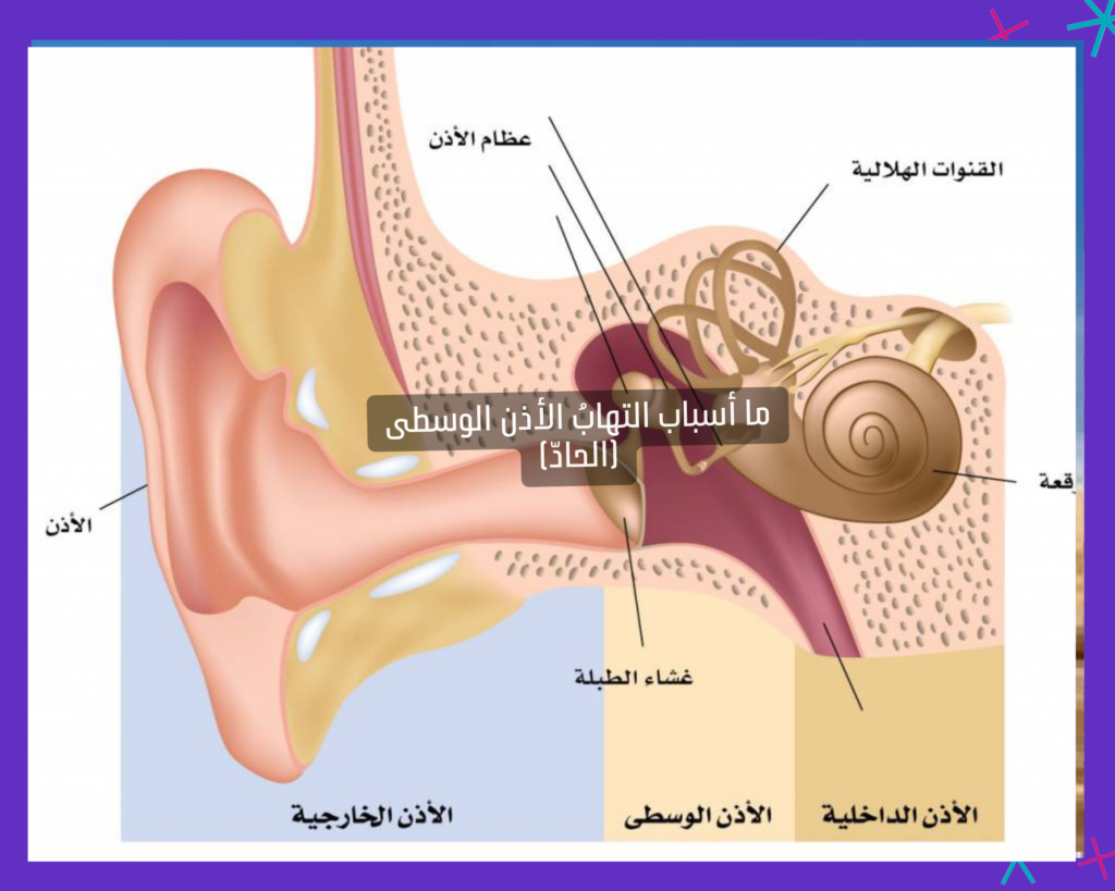 ما أسباب التهابُ الأذن الوسطى (الحادّ)