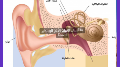 ما أسباب التهابُ الأذن الوسطى (الحادّ)